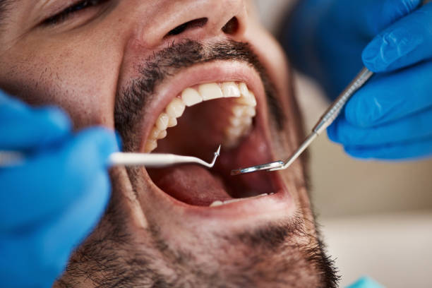 Best Emergency Denture Repair in Grissom Af, IN